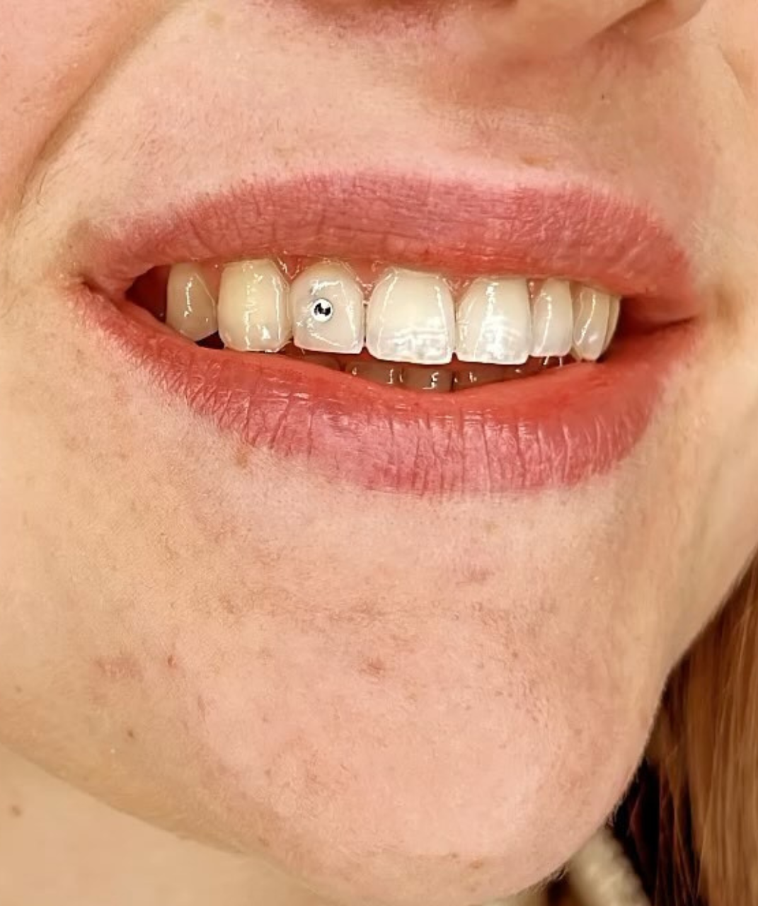 eden-tattoo-39 - Strass Dentaire | Piercing Dent par Eden Tattoo